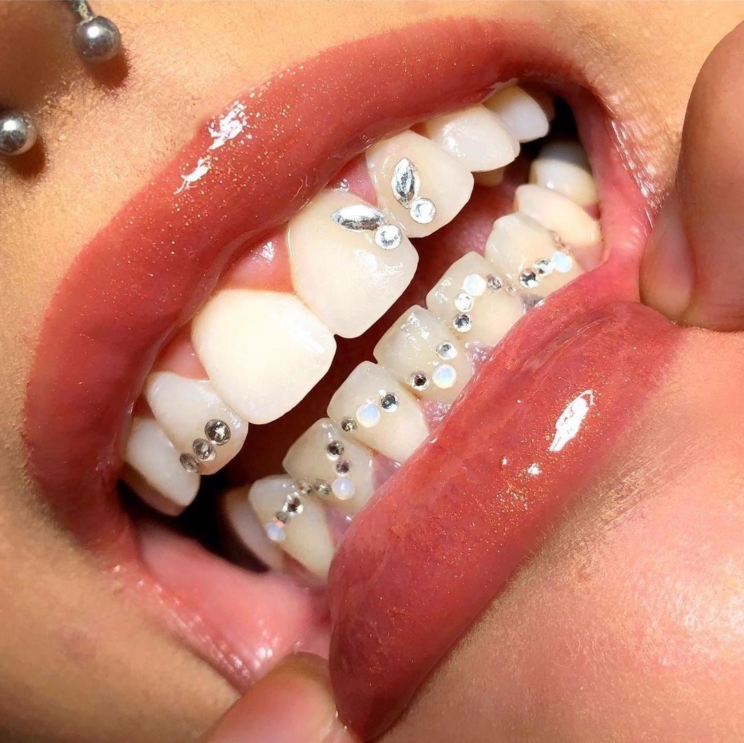 Tooth gem trend explained: Where did it come from?