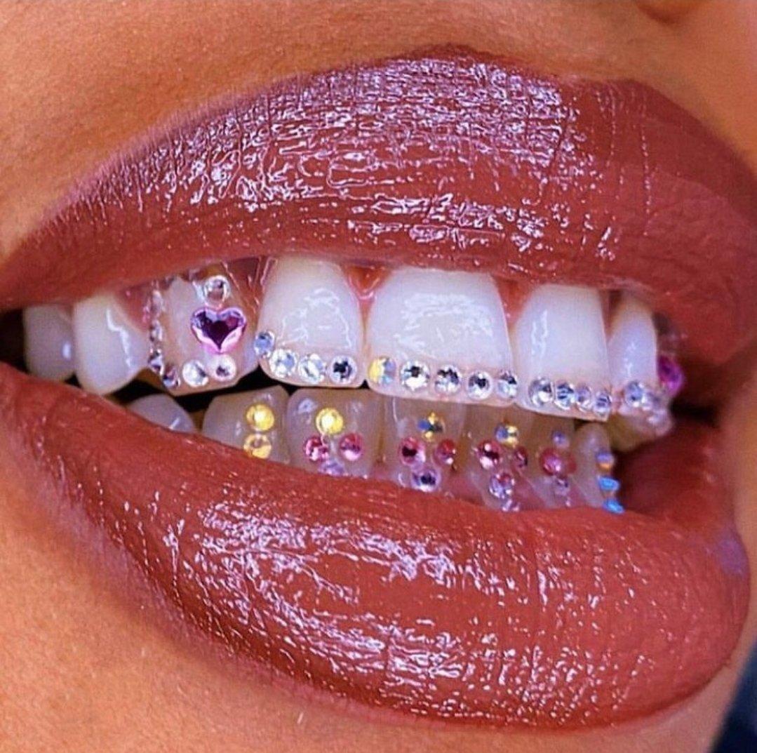 All About Celebrity Tooth Gems